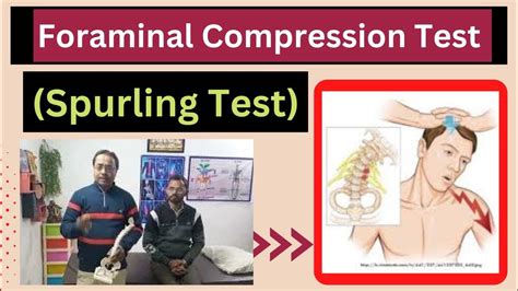 cervical axial compression test|foraminal compression test positive.